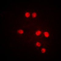 MED1 / TRAP220 Antibody - Immunofluorescent analysis of TRAP220 (pT1457) staining in Jurkat cells. Formalin-fixed cells were permeabilized with 0.1% Triton X-100 in TBS for 5-10 minutes and blocked with 3% BSA-PBS for 30 minutes at room temperature. Cells were probed with the primary antibody in 3% BSA-PBS and incubated overnight at 4 deg C in a humidified chamber. Cells were washed with PBST and incubated with a DyLight 594-conjugated secondary antibody (red) in PBS at room temperature in the dark. DAPI was used to stain the cell nuclei (blue).