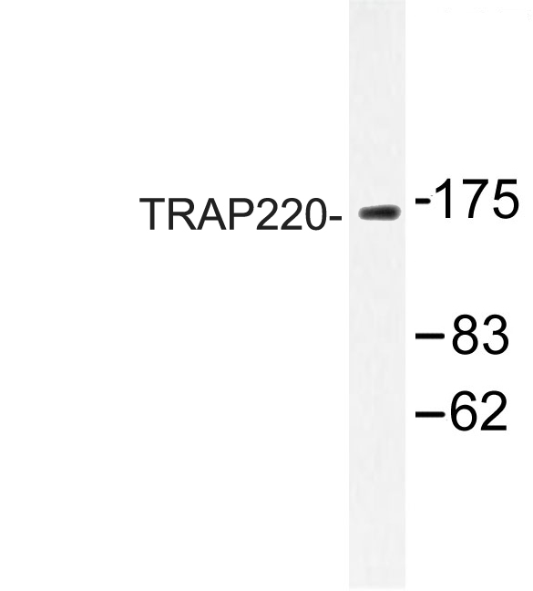 MED1 / TRAP220 Antibody - Western blot of TRAP220 (P697) pAb in extracts from Jurkat cells.