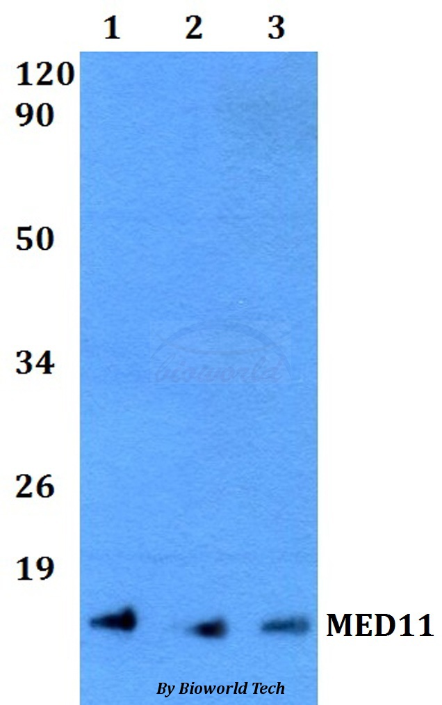 MED11 Antibody - Western blot of MED11 antibody at 1:500 dilution. Lane 1: HeLa whole cell lysate. Lane 2: NIH-3T3 whole cell lysate. Lane 3: PC12 whole cell lysate.