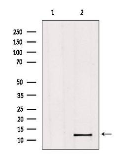 MED11 Antibody - Western blot analysis of extracts of HeLa cells using MED11 antibody. Lane 1 was treated with the blocking peptide.