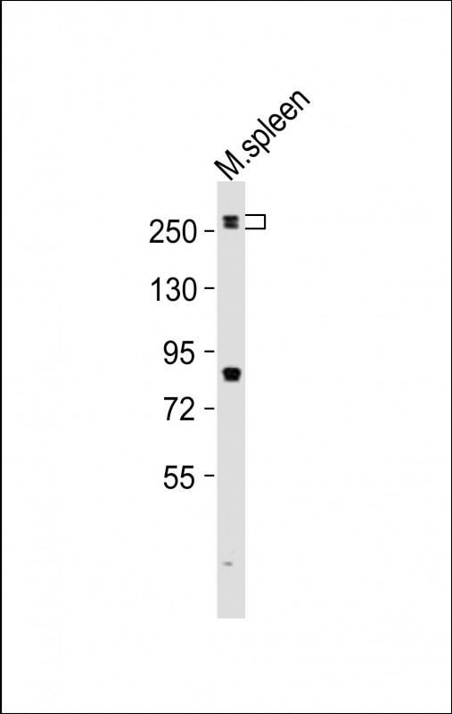 MED12 Antibody - Anti-Med12 Antibody at 1:1000 dilution + mouse spleen lysates Lysates/proteins at 20 ug per lane. Secondary Goat Anti-Rabbit IgG, (H+L), Peroxidase conjugated at 1/10000 dilution Predicted band size : 245 kDa Blocking/Dilution buffer: 5% NFDM/TBST.