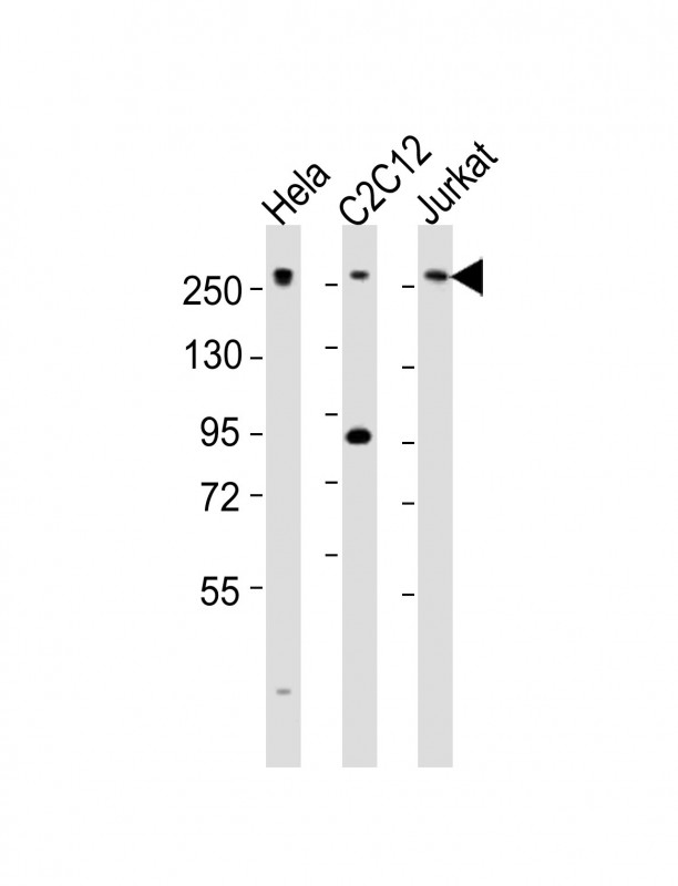 MED12 Antibody - All lanes : Anti-Med12 Antibody at 1:2000 dilution Lane 1: HeLa whole cell lysates Lane 2: C2C12 whole cell lysates Lane 3: Jurkat whole cell lysates Lysates/proteins at 20 ug per lane. Secondary Goat Anti-Rabbit IgG, (H+L), Peroxidase conjugated at 1/10000 dilution Predicted band size : 245 kDa Blocking/Dilution buffer: 5% NFDM/TBST.