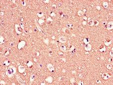MED12 Antibody - Immunohistochemistry of paraffin-embedded human brain tissue using MED12 Antibody at dilution of 1:100