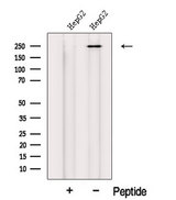 MED12 Antibody - Western blot analysis of extracts of HepG2 cells using MED12 antibody. The lane on the left was treated with blocking peptide.