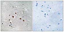 MED13L Antibody - Immunohistochemistry analysis of paraffin-embedded human brain tissue, using MED13L Antibody. The picture on the right is blocked with the synthesized peptide.