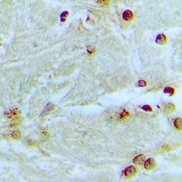 MED13L Antibody - Immunohistochemical analysis of MED13L staining in human brain formalin fixed paraffin embedded tissue section. The section was pre-treated using heat mediated antigen retrieval with sodium citrate buffer (pH 6.0). The section was then incubated with the antibody at room temperature and detected using an HRP conjugated compact polymer system. DAB was used as the chromogen. The section was then counterstained with haematoxylin and mounted with DPX.