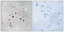 MED13L Antibody - Peptide - + Immunohistochemistry analysis of paraffin-embedded human brain tissue using MED13L antibody.