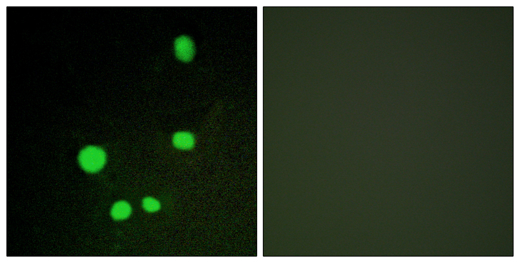 MED14 Antibody - Immunofluorescence analysis of COS7 cells, using MED14 Antibody. The picture on the right is blocked with the synthesized peptide.