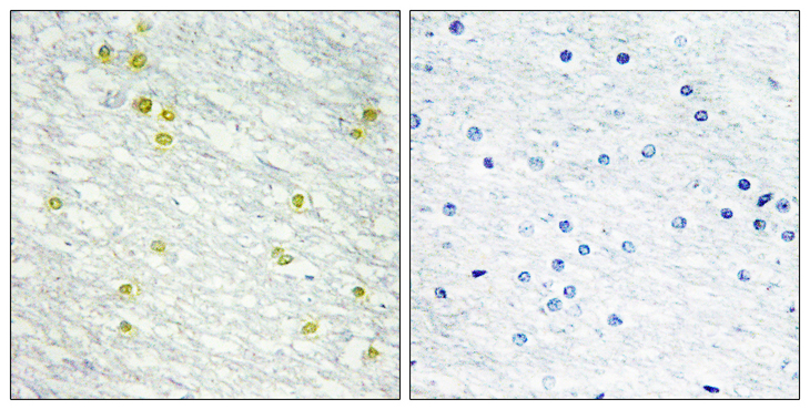 MED14 Antibody - Immunohistochemistry analysis of paraffin-embedded human brain tissue, using MED14 Antibody. The picture on the right is blocked with the synthesized peptide.