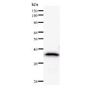 MED14 Antibody - Western blot analysis of immunized recombinant protein, using anti-CRSP2 monoclonal antibody.