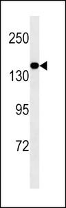 MED14 Antibody - MED14 Antibody western blot of mouse brain tissue lysates (35 ug/lane). The MED14 antibody detected the MED14 protein (arrow).
