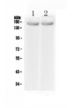 MED14 Antibody - Western blot - Anti-MED14/Crsp2 Picoband Antibody