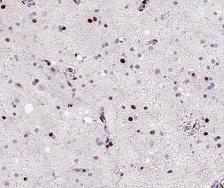 MED14 Antibody - 1:100 staining human brain tissue by IHC-P. The tissue was formaldehyde fixed and a heat mediated antigen retrieval step in citrate buffer was performed. The tissue was then blocked and incubated with the antibody for 1.5 hours at 22°C. An HRP conjugated goat anti-rabbit antibody was used as the secondary.