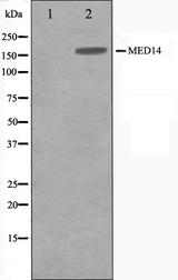 MED14 Antibody - Western blot analysis of MED14 antibody expression in HeLa cells lysates. The lane on the left is treated with the antigen-specific peptide.