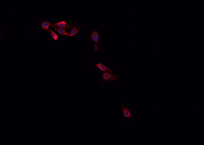 MED14 Antibody - Staining HepG2 cells by IF/ICC. The samples were fixed with PFA and permeabilized in 0.1% Triton X-100, then blocked in 10% serum for 45 min at 25°C. The primary antibody was diluted at 1:200 and incubated with the sample for 1 hour at 37°C. An Alexa Fluor 594 conjugated goat anti-rabbit IgG (H+L) antibody, diluted at 1/600, was used as secondary antibody.