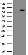 MED15 / ARC105 Antibody - HEK293T cells were transfected with the pCMV6-ENTRY control. (Left lane) or pCMV6-ENTRY MED15. (Right lane) cDNA for 48 hrs and lysed. Equivalent amounts of cell lysates. (5 ug per lane) were separated by SDS-PAGE and immunoblotted with anti-MED15.