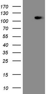 MED15 / ARC105 Antibody - HEK293T cells were transfected with the pCMV6-ENTRY control (Left lane) or pCMV6-ENTRY MED15 (Right lane) cDNA for 48 hrs and lysed. Equivalent amounts of cell lysates (5 ug per lane) were separated by SDS-PAGE and immunoblotted with anti-MED15.