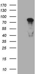 MED15 / ARC105 Antibody - HEK293T cells were transfected with the pCMV6-ENTRY control. (Left lane) or pCMV6-ENTRY MED15. (Right lane) cDNA for 48 hrs and lysed. Equivalent amounts of cell lysates. (5 ug per lane) were separated by SDS-PAGE and immunoblotted with anti-MED15.