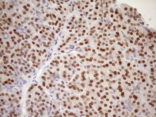 MED15 / ARC105 Antibody - Immunohistochemical staining of paraffin-embedded Human pancreas tissue within the normal limits using anti-MED15 mouse monoclonal antibody. (Heat-induced epitope retrieval by 1mM EDTA in 10mM Tris buffer. (pH8.5) at 120°C for 3 min. (1:150)