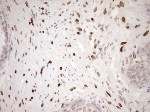 MED15 / ARC105 Antibody - Immunohistochemical staining of paraffin-embedded Human prostate tissue within the normal limits using anti-MED15 mouse monoclonal antibody. (Heat-induced epitope retrieval by 1mM EDTA in 10mM Tris buffer. (pH8.5) at 120°C for 3 min. (1:150)