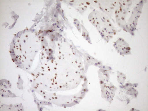 MED15 / ARC105 Antibody - Immunohistochemical staining of paraffin-embedded Human bladder tissue within the normal limits using anti-MED15 mouse monoclonal antibody. (Heat-induced epitope retrieval by 1mM EDTA in 10mM Tris buffer. (pH8.5) at 120°C for 3 min. (1:150)