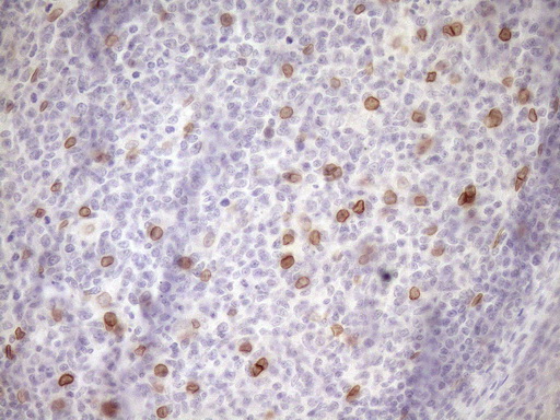 MED15 / ARC105 Antibody - Immunohistochemical staining of paraffin-embedded Human tonsil within the normal limits using anti-MED15 mouse monoclonal antibody. (Heat-induced epitope retrieval by 1mM EDTA in 10mM Tris buffer. (pH8.5) at 120°C for 3 min. (1:150)