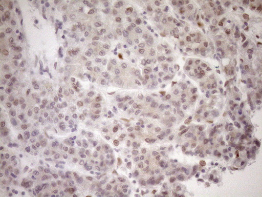 MED15 / ARC105 Antibody - Immunohistochemical staining of paraffin-embedded Human liver tissue within the normal limits using anti-MED15 mouse monoclonal antibody. (Heat-induced epitope retrieval by 1mM EDTA in 10mM Tris buffer. (pH8.5) at 120°C for 3 min. (1:150)