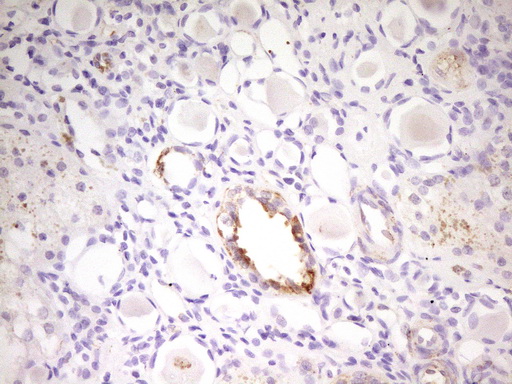 MED15 / ARC105 Antibody - Immunohistochemical staining of paraffin-embedded Human Kidney tissue within the normal limits using anti-MED15 mouse monoclonal antibody. (Heat-induced epitope retrieval by 1 mM EDTA in 10mM Tris, pH8.5, 120C for 3min,