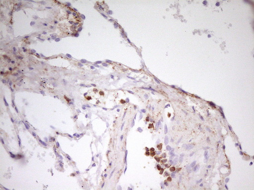 MED15 / ARC105 Antibody - Immunohistochemical staining of paraffin-embedded Human lung tissue within the normal limits using anti-MED15 mouse monoclonal antibody. (Heat-induced epitope retrieval by 1 mM EDTA in 10mM Tris, pH8.5, 120C for 3min,