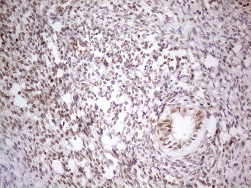 MED15 / ARC105 Antibody - Immunohistochemical staining of paraffin-embedded Human endometrium tissue within the normal limits using anti-MED15 mouse monoclonal antibody. (Heat-induced epitope retrieval by 1mM EDTA in 10mM Tris buffer. (pH8.5) at 120°C for 3 min. (1:150)