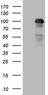 MED15 / ARC105 Antibody - HEK293T cells were transfected with the pCMV6-ENTRY control. (Left lane) or pCMV6-ENTRY MED15. (Right lane) cDNA for 48 hrs and lysed. Equivalent amounts of cell lysates. (5 ug per lane) were separated by SDS-PAGE and immunoblotted with anti-MED15.