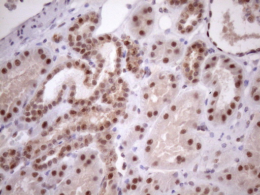 MED15 / ARC105 Antibody - Immunohistochemical staining of paraffin-embedded Human Kidney tissue within the normal limits using anti-MED15 mouse monoclonal antibody. (Heat-induced epitope retrieval by 1mM EDTA in 10mM Tris buffer. (pH8.5) at 120 oC for 3 min. (1:150)