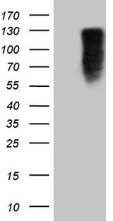 MED15 / ARC105 Antibody - HEK293T cells were transfected with the pCMV6-ENTRY control. (Left lane) or pCMV6-ENTRY MED15. (Right lane) cDNA for 48 hrs and lysed. Equivalent amounts of cell lysates. (5 ug per lane) were separated by SDS-PAGE and immunoblotted with anti-MED15. (1:2000)