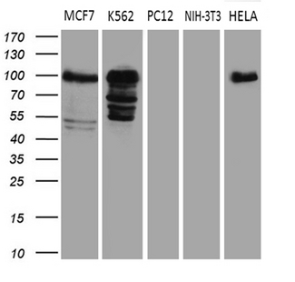 MED15 / ARC105 Antibody - Western blot analysis of extracts. (35ug) from 5 different cell lines by using anti-MED15 monoclonal antibody. (1:500)