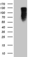 MED15 / ARC105 Antibody - HEK293T cells were transfected with the pCMV6-ENTRY control. (Left lane) or pCMV6-ENTRY MED15. (Right lane) cDNA for 48 hrs and lysed