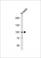 MED15 / ARC105 Antibody - Anti-Med15 Antibody at 1:1000 dilution + mouse testis lysates Lysates/proteins at 20 ug per lane. Secondary Goat Anti-Rabbit IgG, (H+L), Peroxidase conjugated at 1/10000 dilution Predicted band size : 87 kDa Blocking/Dilution buffer: 5% NFDM/TBST.