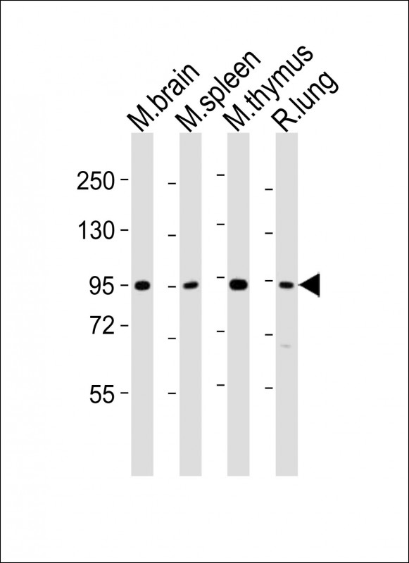 MED15 / ARC105 Antibody - All lanes : Anti-Med15 Antibody at 1:2000 dilution Lane 1: mouse brain lysates Lane 2: mouse spleen lysates Lane 3: mouse thymus lysates Lane 4: rat lung lysates Lysates/proteins at 20 ug per lane. Secondary Goat Anti-Rabbit IgG, (H+L), Peroxidase conjugated at 1/10000 dilution Predicted band size : 87 kDa Blocking/Dilution buffer: 5% NFDM/TBST.