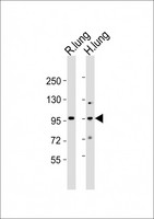 MED15 / ARC105 Antibody - All lanes : Anti-Med15 Antibody at 1:2000 dilution Lane 1: rat lung lysates Lane 2: human lung lysates Lysates/proteins at 20 ug per lane. Secondary Goat Anti-Rabbit IgG, (H+L), Peroxidase conjugated at 1/10000 dilution Predicted band size : 87 kDa Blocking/Dilution buffer: 5% NFDM/TBST.