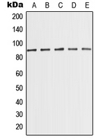 MED15 / ARC105 Antibody - Western blot analysis of MED15 expression in MCF7 (A); K562 (B); HeLa (C); NIH3T3 (D); PC12 (E) whole cell lysates.