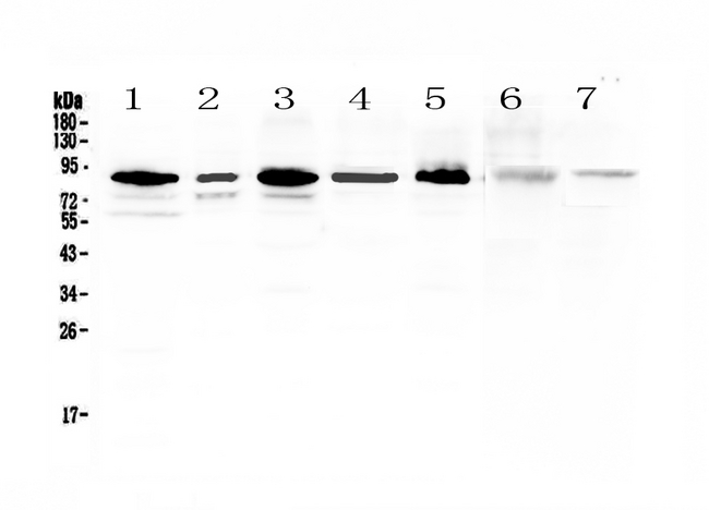 MED15 / ARC105 Antibody - Western blot - Anti-MED15/Pcqap Picoband Antibody
