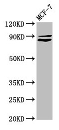 MED15 / ARC105 Antibody - Western Blot Positive WB detected in: MCF-7 whole cell lysate All lanes: MED15 antibody at 5.2µg/ml Secondary Goat polyclonal to rabbit IgG at 1/50000 dilution Predicted band size: 87, 83, 76 kDa Observed band size: 87 kDa