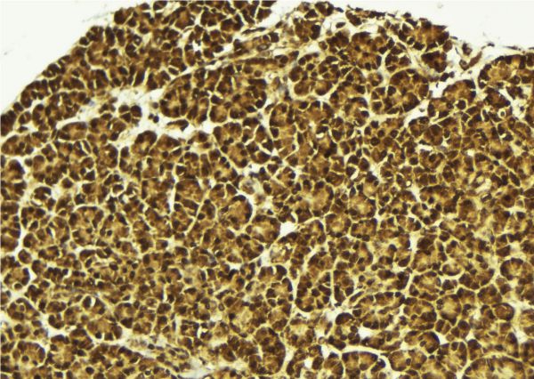 MED15 / ARC105 Antibody - 1:100 staining mouse pancreas tissue by IHC-P. The sample was formaldehyde fixed and a heat mediated antigen retrieval step in citrate buffer was performed. The sample was then blocked and incubated with the antibody for 1.5 hours at 22°C. An HRP conjugated goat anti-rabbit antibody was used as the secondary.