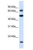 MED16 / THRAP5 Antibody - MED16 / THRAP5 antibody Western Blot of 293T. Antibody dilution: 1 ug/ml.  This image was taken for the unconjugated form of this product. Other forms have not been tested.