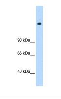 MED16 / THRAP5 Antibody - 721_B cell lysate. Antibody concentration: 0.5 ug/ml. Gel concentration: 8%.  This image was taken for the unconjugated form of this product. Other forms have not been tested.