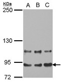 MED16 / THRAP5 Antibody - Sample (30 ug of whole cell lysate) A: A431 B: HeLa C: HepG2 5% SDS PAGE MED16 / THRAP5 antibody diluted at 1:1000