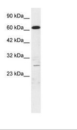 MED17 / TRAP80 Antibody - HepG2 Cell Lysate.  This image was taken for the unconjugated form of this product. Other forms have not been tested.
