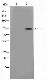 MED17 / TRAP80 Antibody - Western blot of HT29 cell lysate using MED17 Antibody