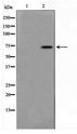 MED17 / TRAP80 Antibody - Western blot of HT29 cell lysate using MED17 Antibody