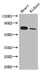 MED17 / TRAP80 Antibody - Positive WB detected in:Mouse heart tissue,Mouse kidney tissue;All lanes: MED17 antibody at 2.8ug/ml;Secondary;Goat polyclonal to rabbit IgG at 1/50000 dilution;Predicted band size: 73,16 kDa;Observed band size: 73 kDa;