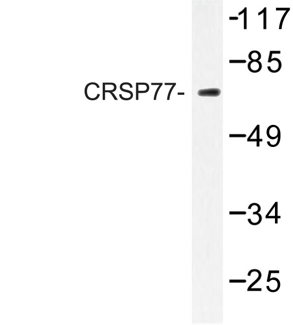 MED17 / TRAP80 Antibody - Western blot of CRSP77 (V171) pAb in extracts from HT-29 cells.
